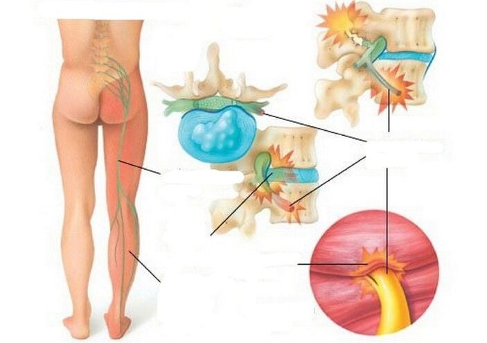 Types and causes of pain