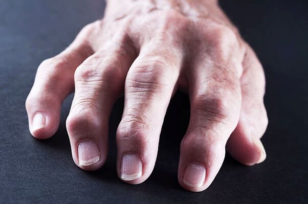 finger joint pain