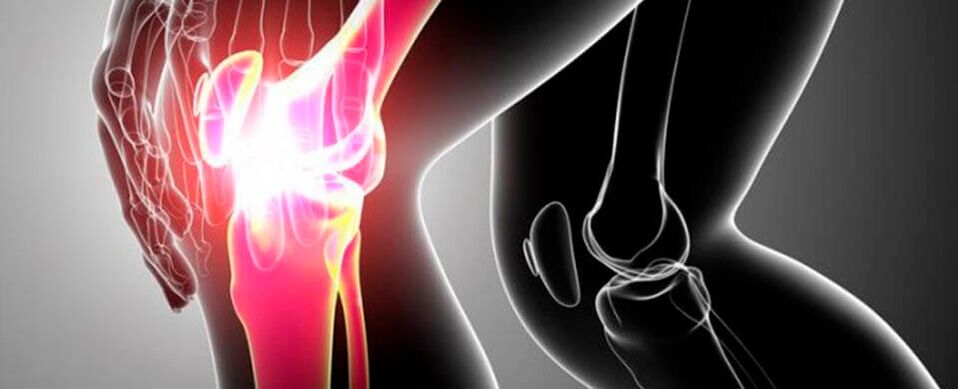 Knee pain photo 4