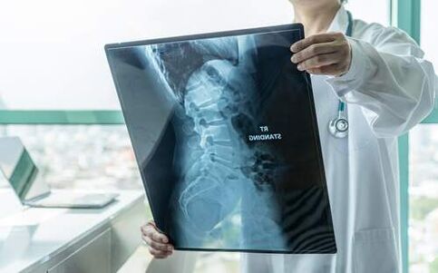 X-rays are necessary to diagnose back pain